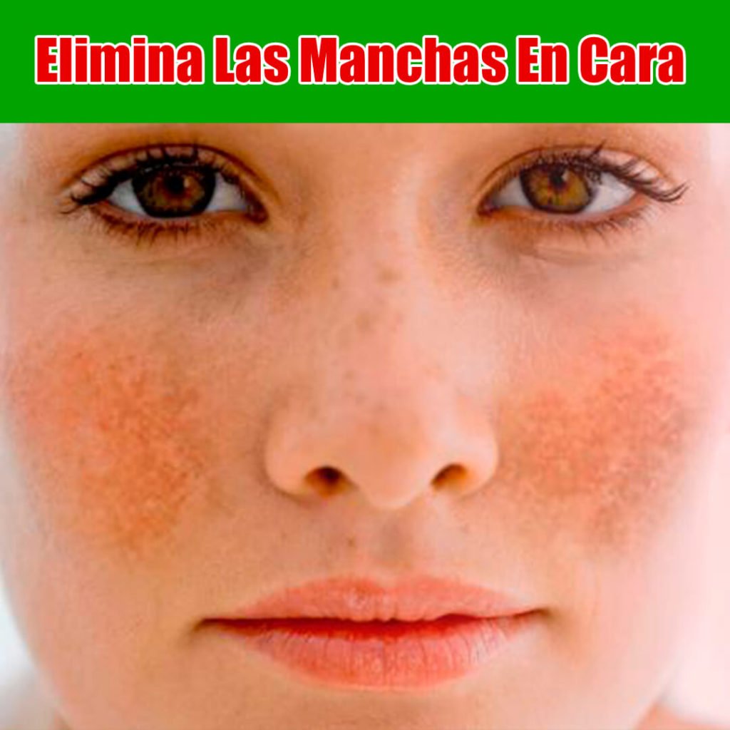 Como eliminar las manchas